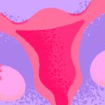 Endometriosis, Método Creighton, FertilityCare Centers of Spain