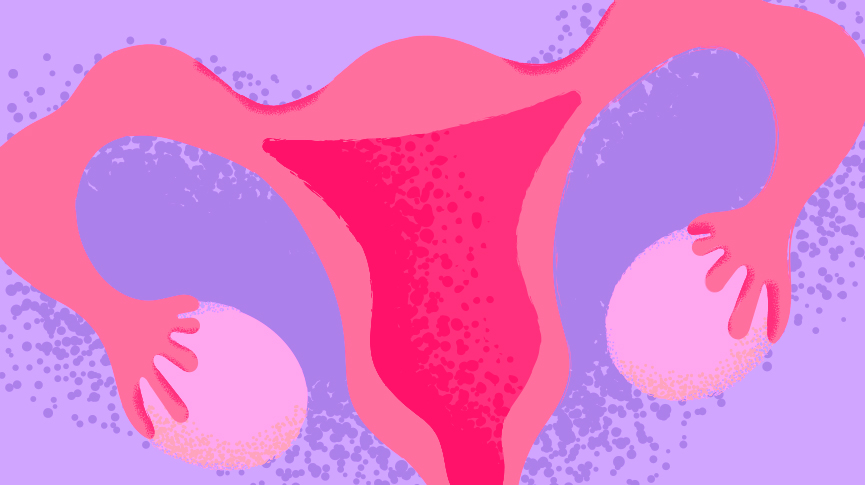 Endometriosis y fertilidad